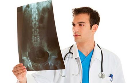 zdravnik pregleda rentgen, da diagnosticira bolečine v križu